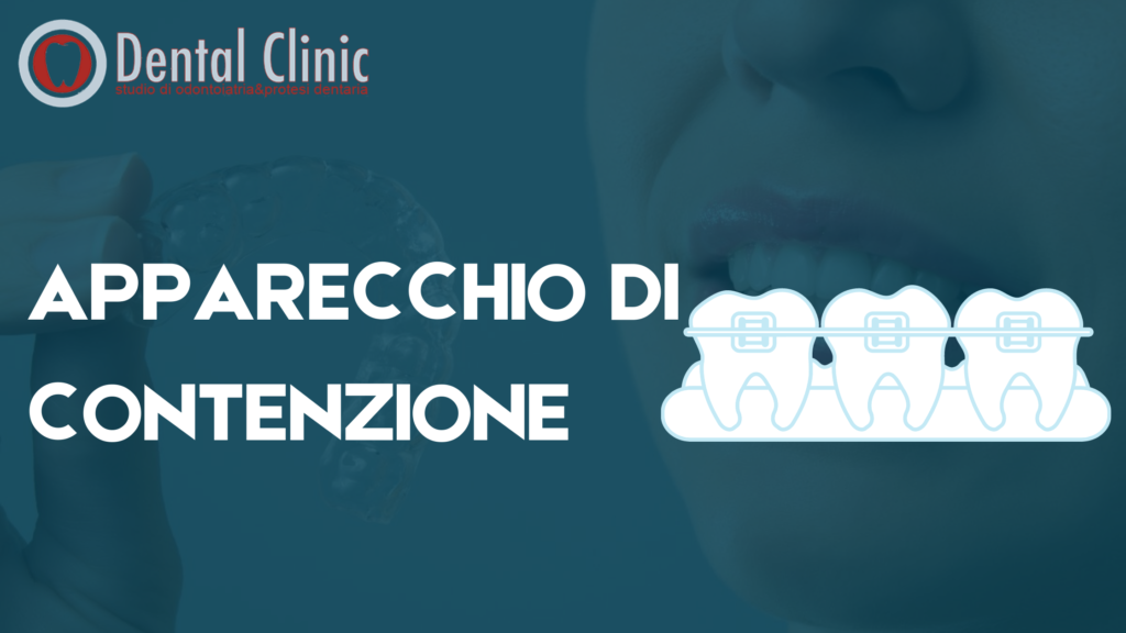 Apparecchio di contenzione