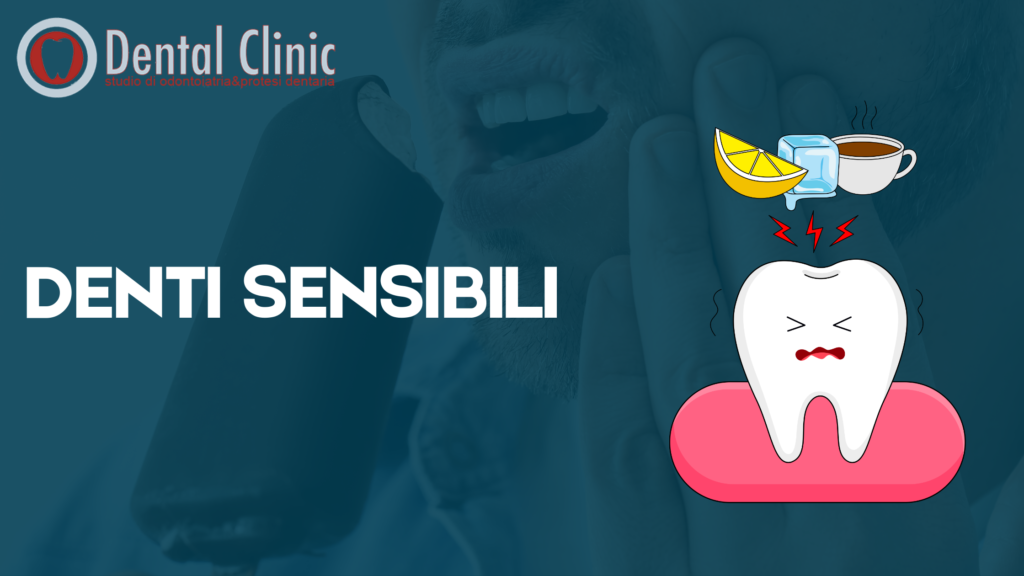 Denti sensibili