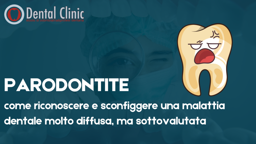 Cura della Parodontite