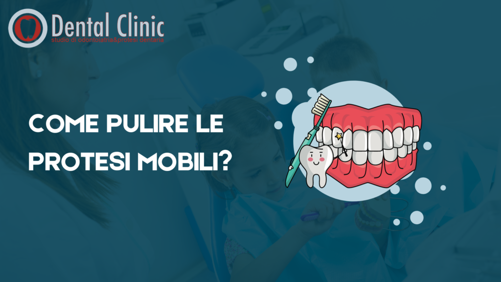 COME PULIRE LE PROTESI MOBILI