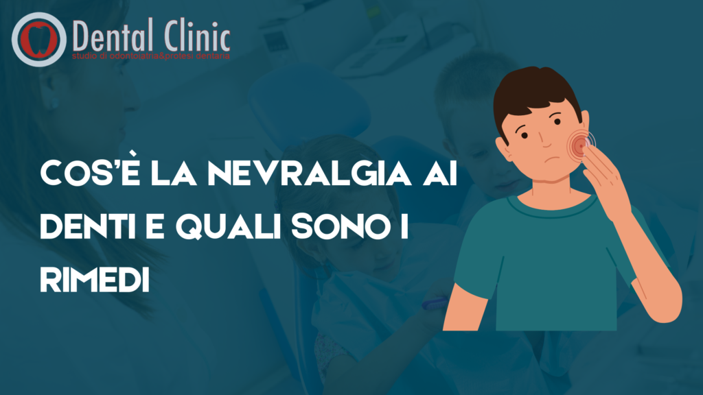 Cos’è la nevralgia ai denti