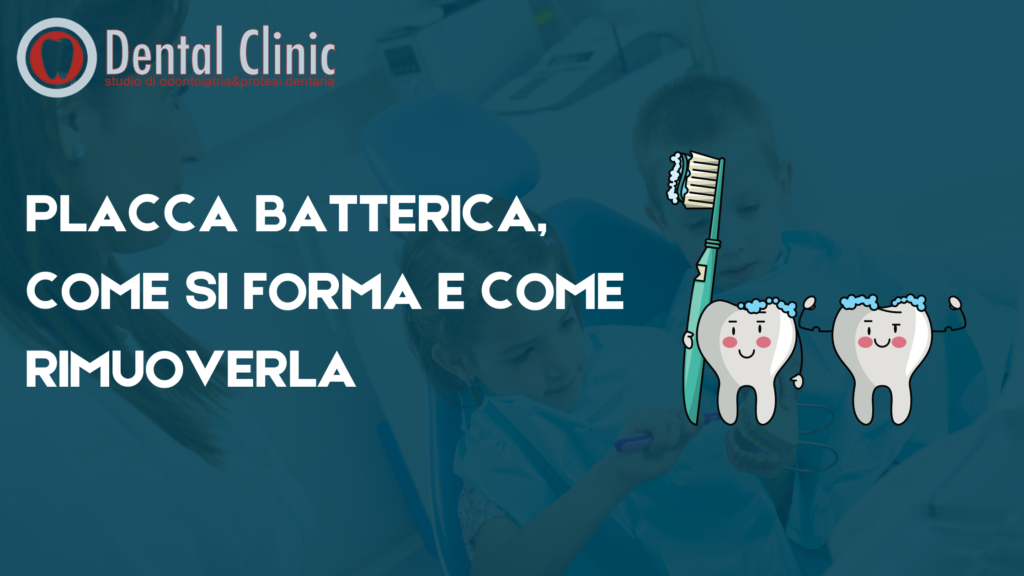 PLACCA BATTERICA COME SI FORMA E COME RIMUOVERLA