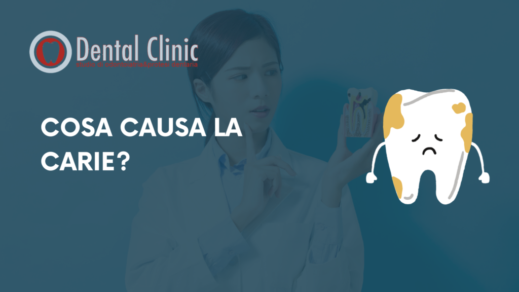COSA CAUSA LA CARIE